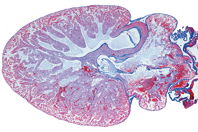 praeparat-20351c1ea37ca842