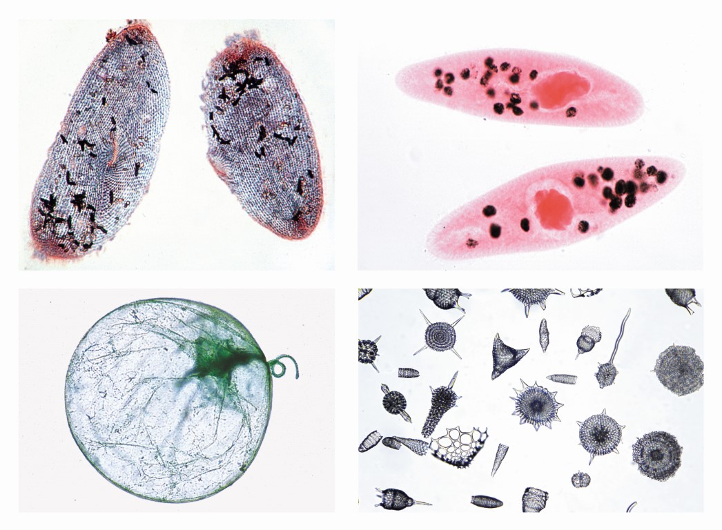 Einzeller (Protozoa), 10 Mikropräparate