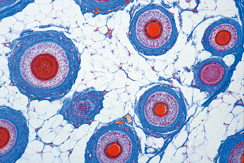 praeparat-20951c1ea38b64ce
