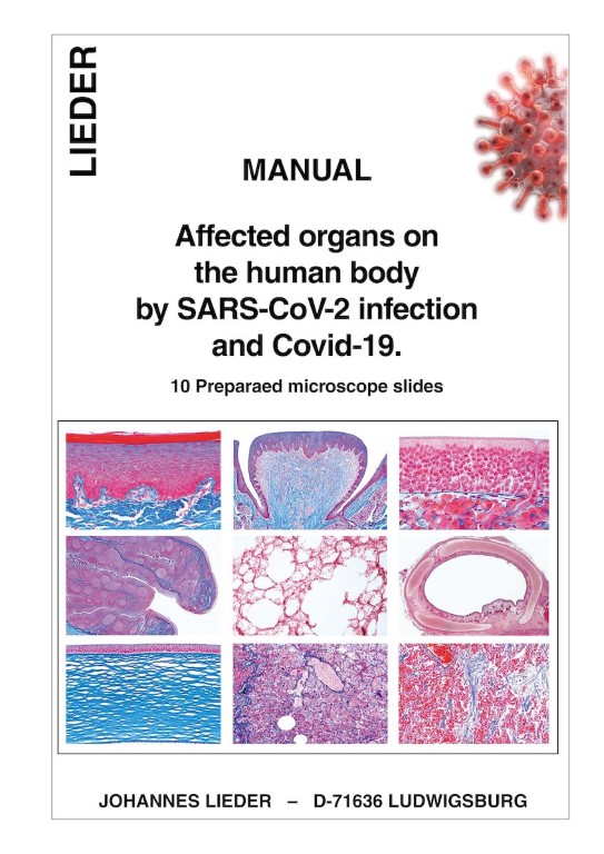 "Corona" - Mikropräparate-Serie 10er Set "Corona" - Mikropräparate-Serie 10er Set
