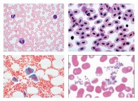 Histologie. Blut, 10 Mikropräparate Histologie. Blut, 10 Mikropräparate