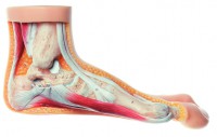 Modell vom Hallux valgus Modell vom Hallux valgus