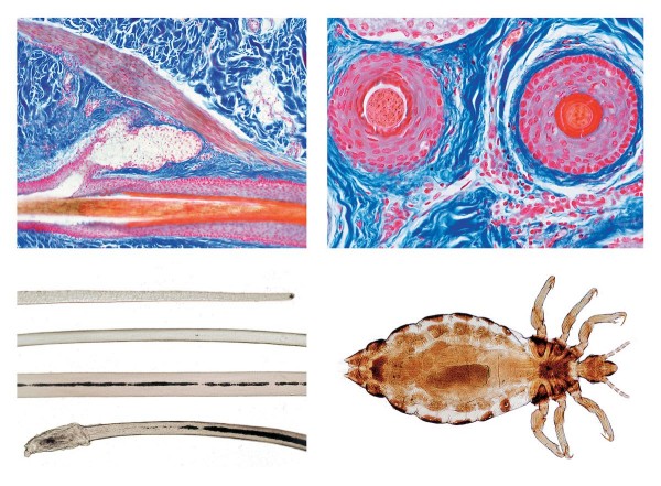 Kopfhaut und Haare des Menschen, Mikropräparat