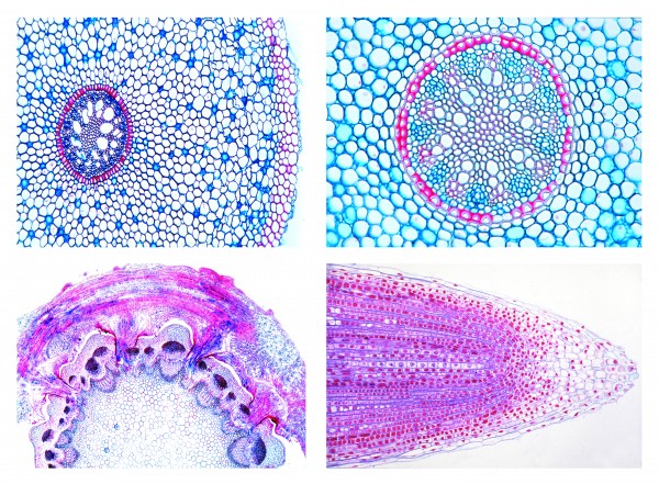 Mikropräparateserie Blütenpflanzen III - Die Wurzel - 15 Präparate