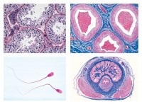 Histologie. Nervensystem, 10 Mikropräparate Histologie. Nervensystem, 10 Mikropräparate