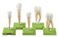 Fünf Zahnmodelle Fünf Zahnmodelle
