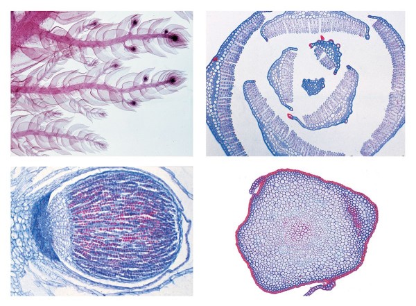 Mikropräpareteserie Moospflanzen (Bryophyta), 15 Präparate