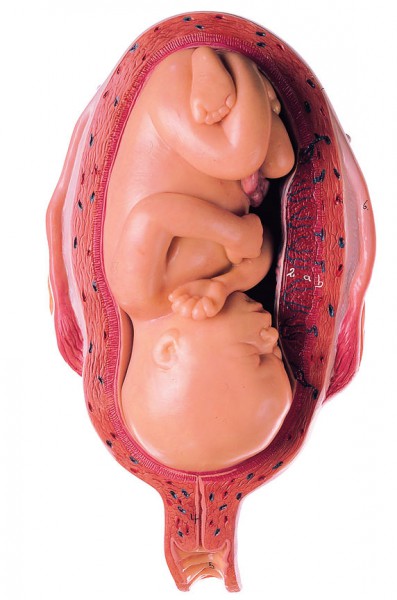 Uterus mit Fetus im 7. Monat