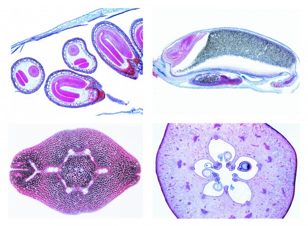 Mikropräparatserie Blütenpflanzen. Frucht und Same, 15 Präparate