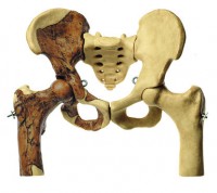 Beckenrekonstruktion von Australopithecus africanus Beckenrekonstruktion von Australopithecus africanus