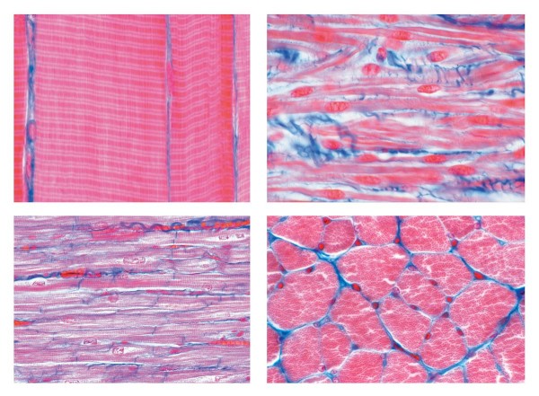 Histologie. Muskelgewebe, 6 Mikropräparate