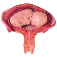 Uterus mit Fetus im 4. bis 5. Monat Uterus mit Fetus im 4. bis 5. Monat