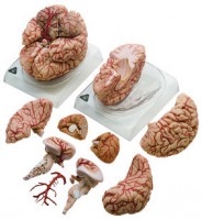 Gehirn mit Arterien Gehirn mit Arterien