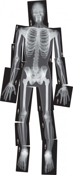 Röntgenbilder Mensch