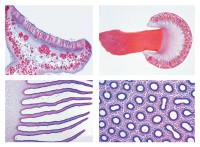Mikropräparateserie Pilze und Flechten (Fungi, Lichenes), 20 Präparate Mikropräparateserie Pilze und Flechten (Fungi, Lichenes), 20 Präparate