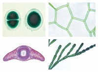 Das Leben im Wassertropfen Teil II, Die Kleinlebewelt unserer Gewässer, 25 Präparate Das Leben im Wassertropfen Teil II, Die Kleinlebewelt unserer Gewässer, 25 Präparate