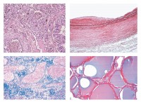 Pathologische Histologie des Menschen, Basisserie, 50 Mikropräparate Pathologische Histologie des Menschen, Basisserie, 50 Mikropräparate