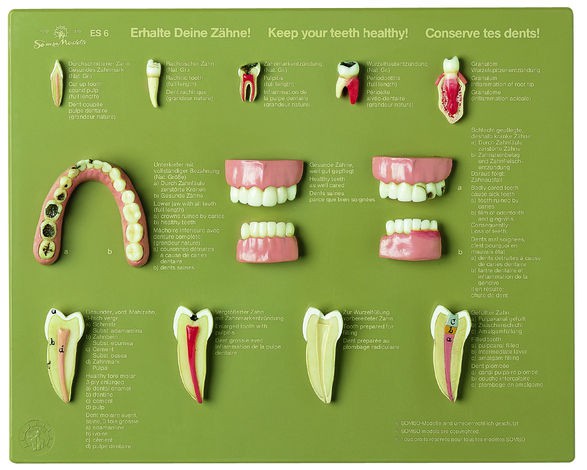 Schaukasten "Erhalte Deine Zähne"