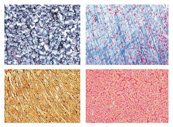 Histologie. Bindegewebe, 10 Mikropräparate