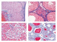 Serie IV. Hormone, Hormonfunktion, 7 Mikropräparate Serie IV. Hormone, Hormonfunktion, 7 Mikropräparate