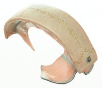 Darstellung der Dura Darstellung der Dura