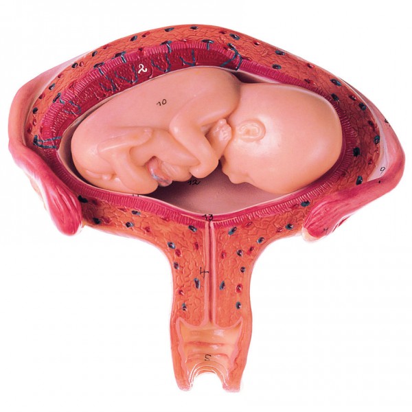 Uterus mit Fetus im 4. bis 5. Monat