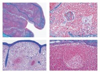 Lymphsysteme Mikropräparate Lymphsysteme Mikropräparate
