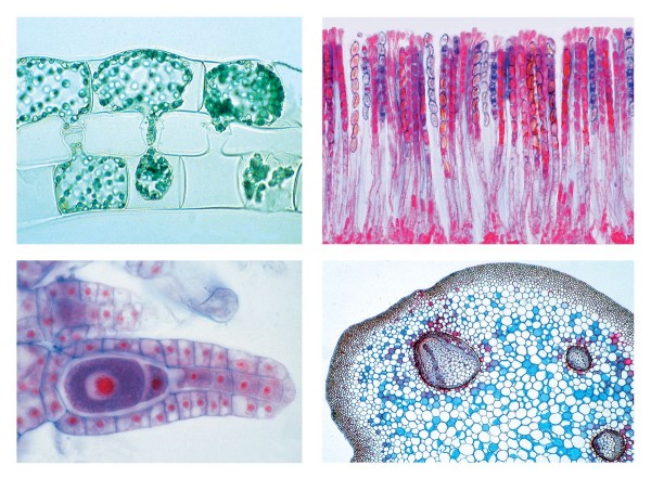Blütenlose Pflanzen (Cryptogamae), Grundserie, 25 Präparate