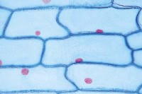 Epidermiszellen Epidermiszellen