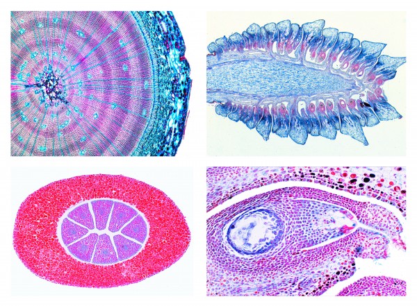 Mikropräpareteserie Nacktsamer (Gymnospermae), 15 Präparate