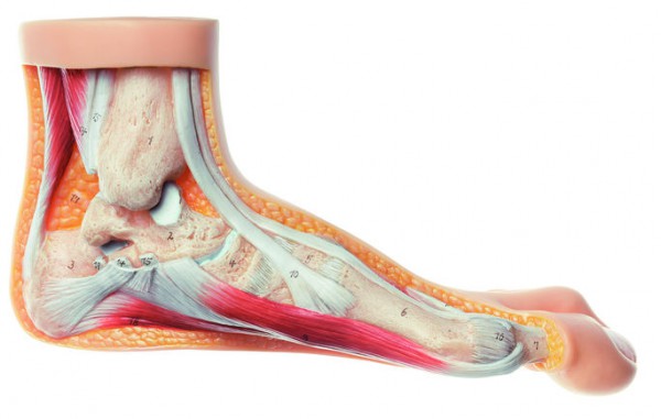 Modell vom Hallux valgus