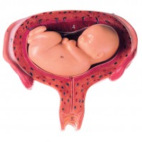 Uterus mit Fetus im 5. Monat Uterus mit Fetus im 5. Monat