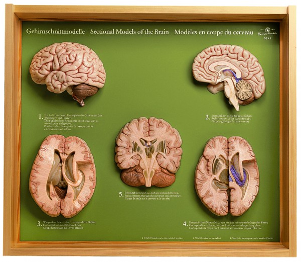 5 Gehirnschnittmodelle