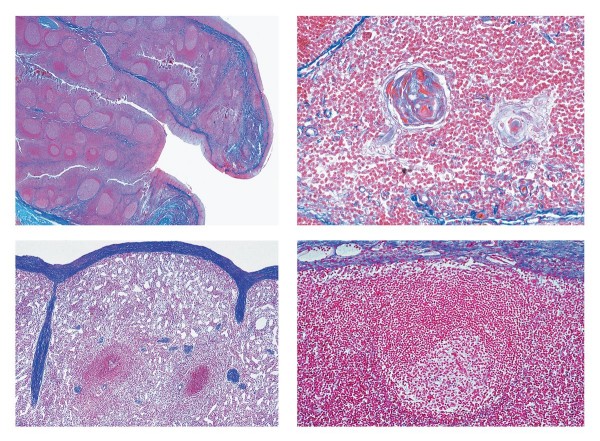 Lymphsysteme Mikropräparate