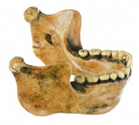 Unterkiefer von Mauer bei Heidelberg, Homo heidelbergensis Unterkiefer von Mauer bei Heidelberg, Homo heidelbergensis