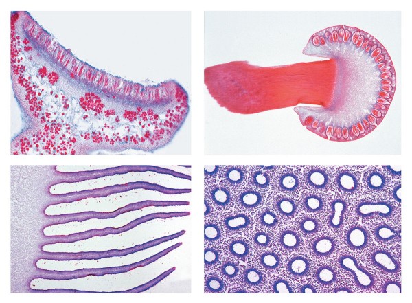 Mikropräparateserie Pilze und Flechten (Fungi, Lichenes), 20 Präparate