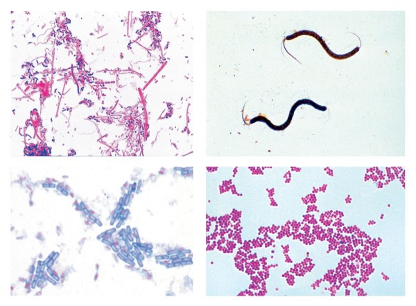 Bakterien, 25 Mikropräparate