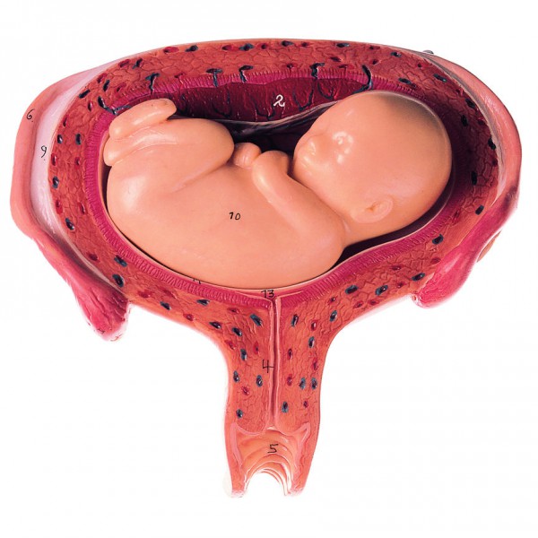 Uterus mit Fetus im 5. Monat