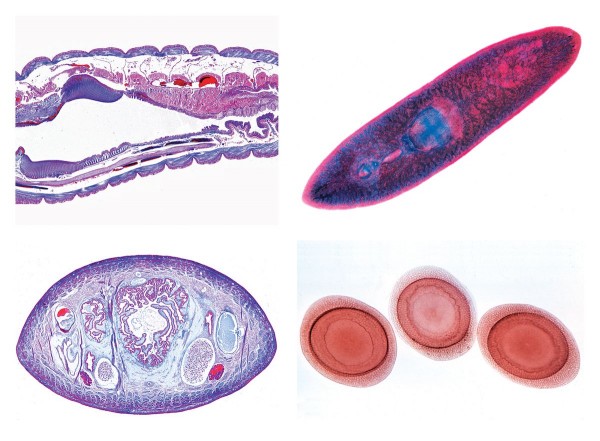 Würmer (Helminthes), 20 Mikropräparate
