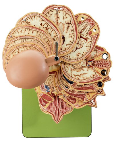 Anatomisches Schnittmodell des Kopfes (in Verbindung mit entsprechenden CT- und MR-Aufnahmen)