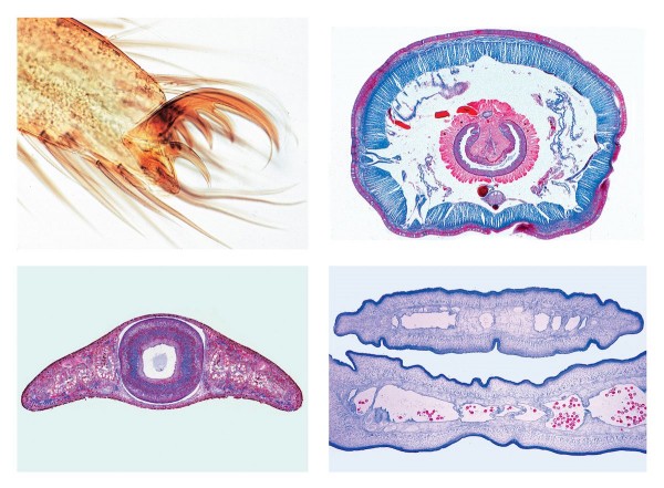 Wirbellose Tiere (Invertebrata), Grundserie 25 Mikropräparate
