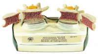 Osteoporose-Modell Osteoporose-Modell